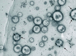 truth about exosomes