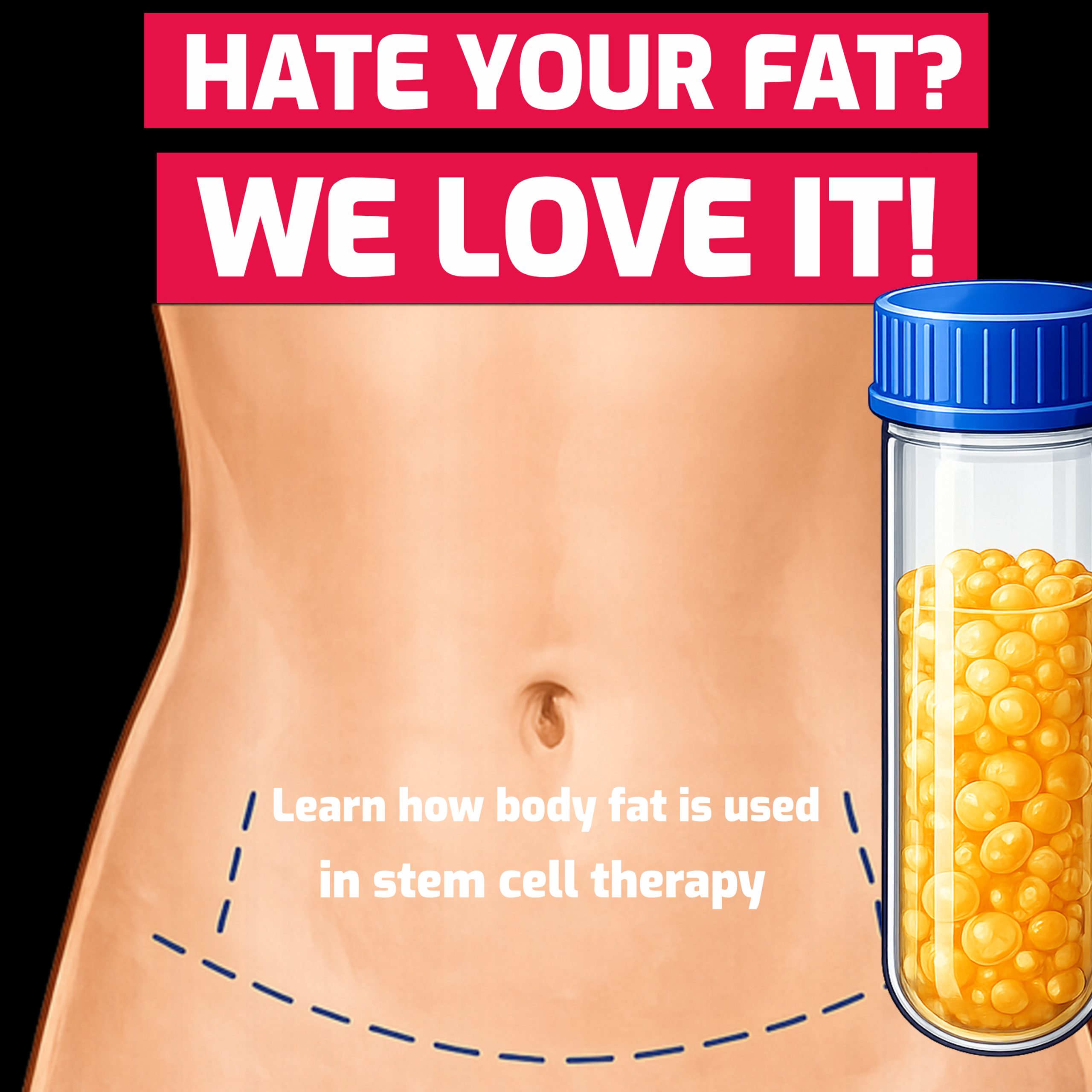 how_fat_is_used_for_stem_cell_therapy
